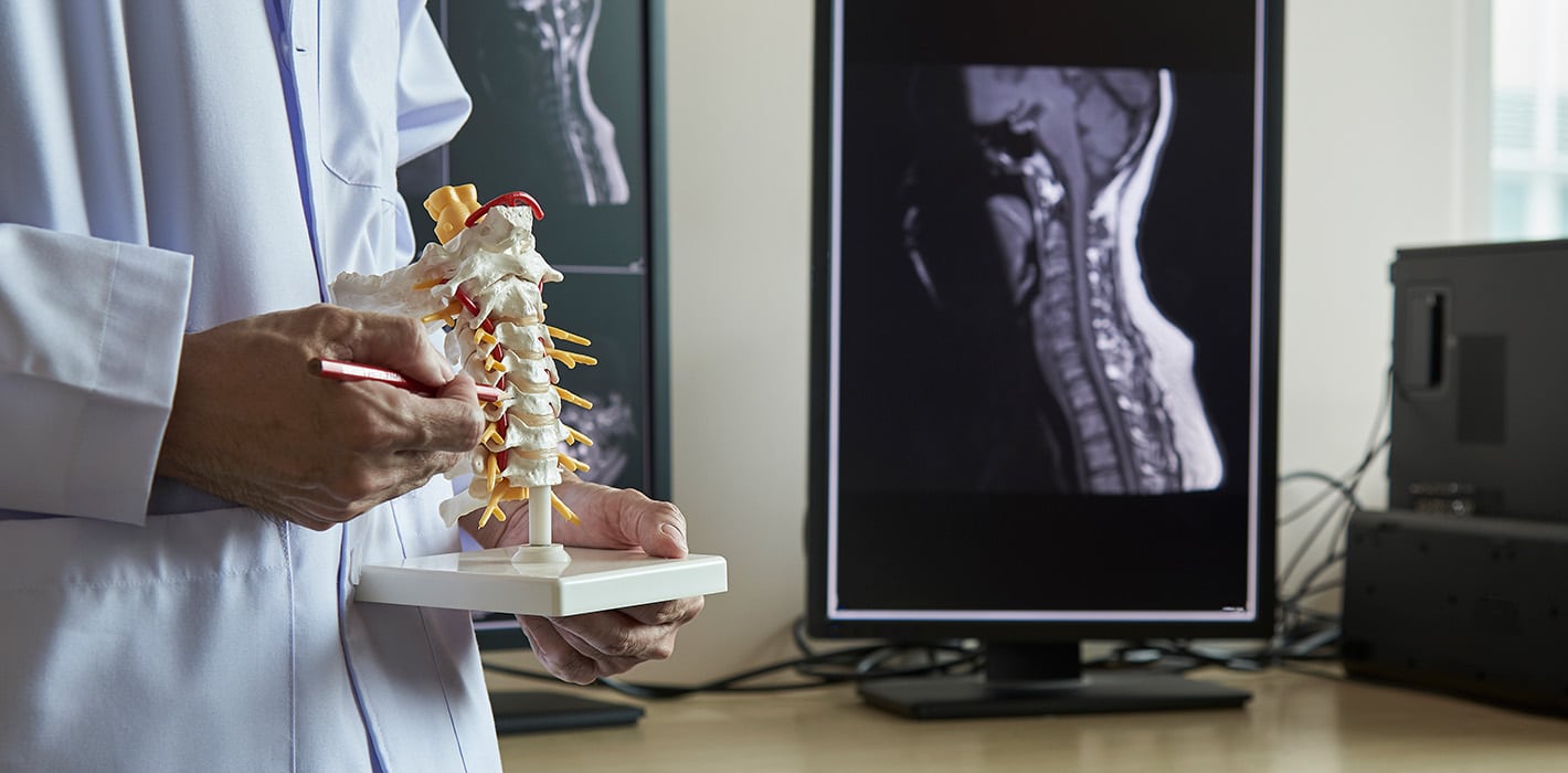 1760653701 neck 1 Symptoms of Osteoporosis and When You Should Seek Treatment