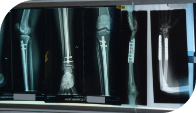 1760653676_imageC-1 1760653676 imageC 1 Orthopedic Services in East Brunswick, NJ